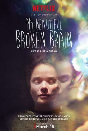 My Beautiful Broken Brain Torrent Download